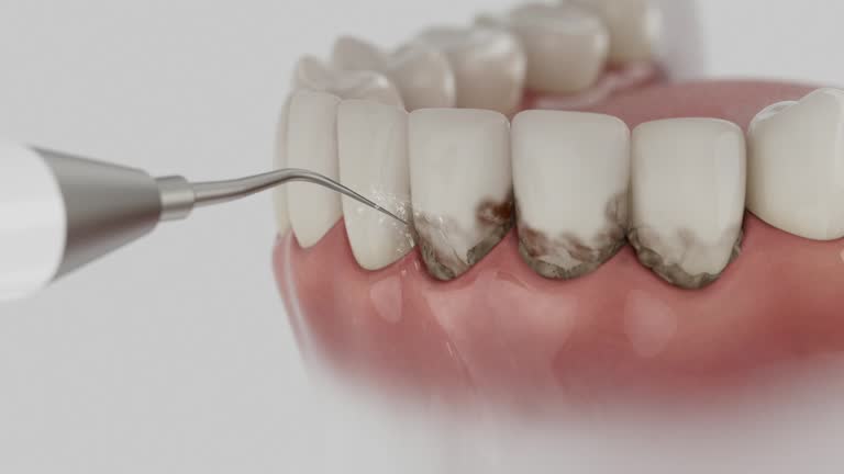 Reliable Dental Implants contractor in Arlington, OH by Smile Center Dentistry